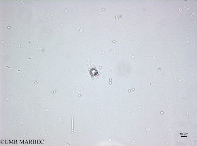 phyto/Brazilian_Amazon_coast/Amazomix_station_22/AMAZOMIX September 2021/Lauderia annulata (Exospores-St22_220909_001_ovl-49).tif(copy)_thumb.jpg